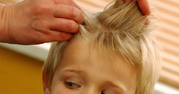 Как выглядят гниды у ребенка на волосах?