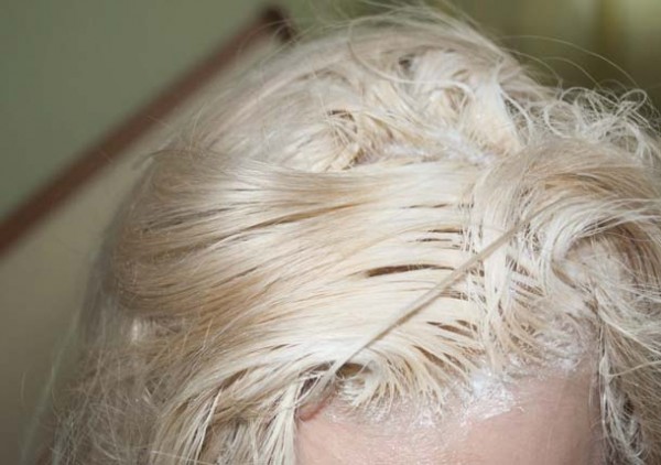 Обесцвечивание волос – правила и предостережения